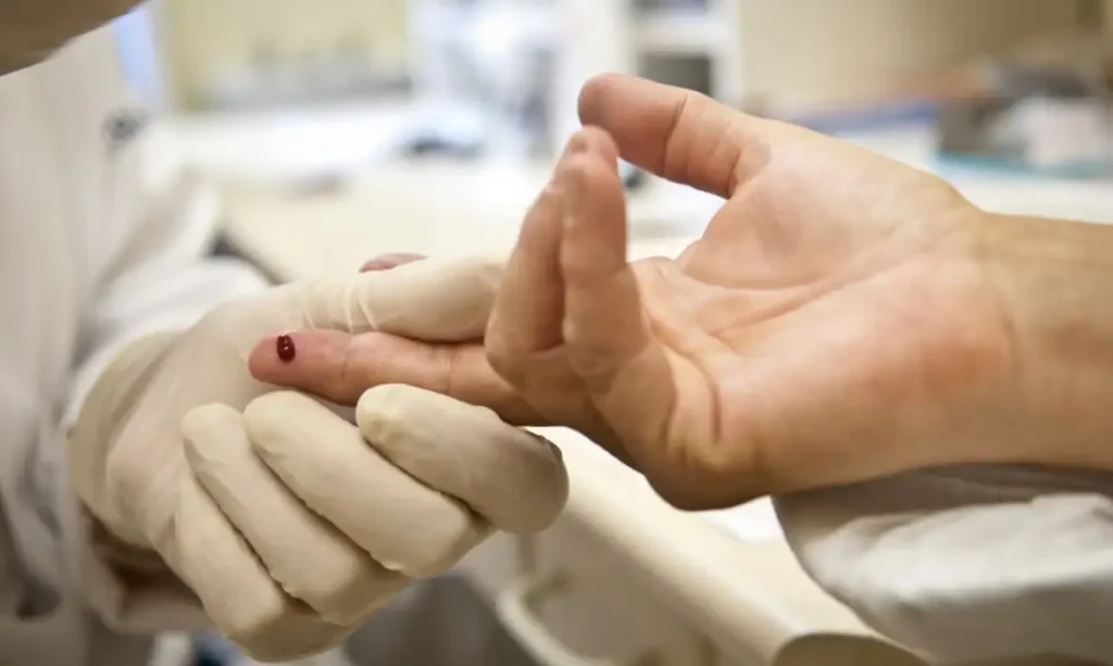 hiv