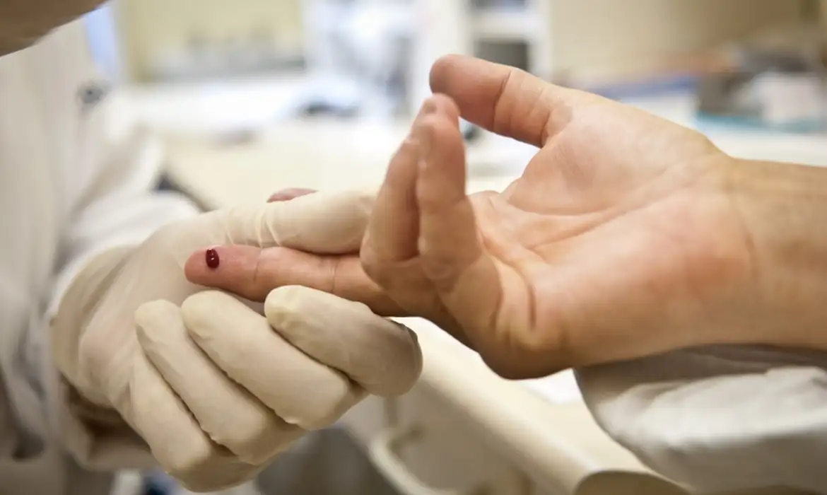 hiv