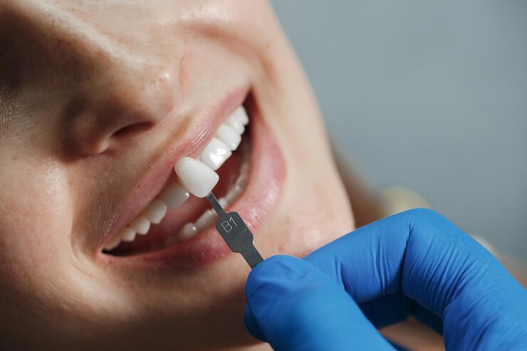 dentista-clareando-os-dentes_624325-1916