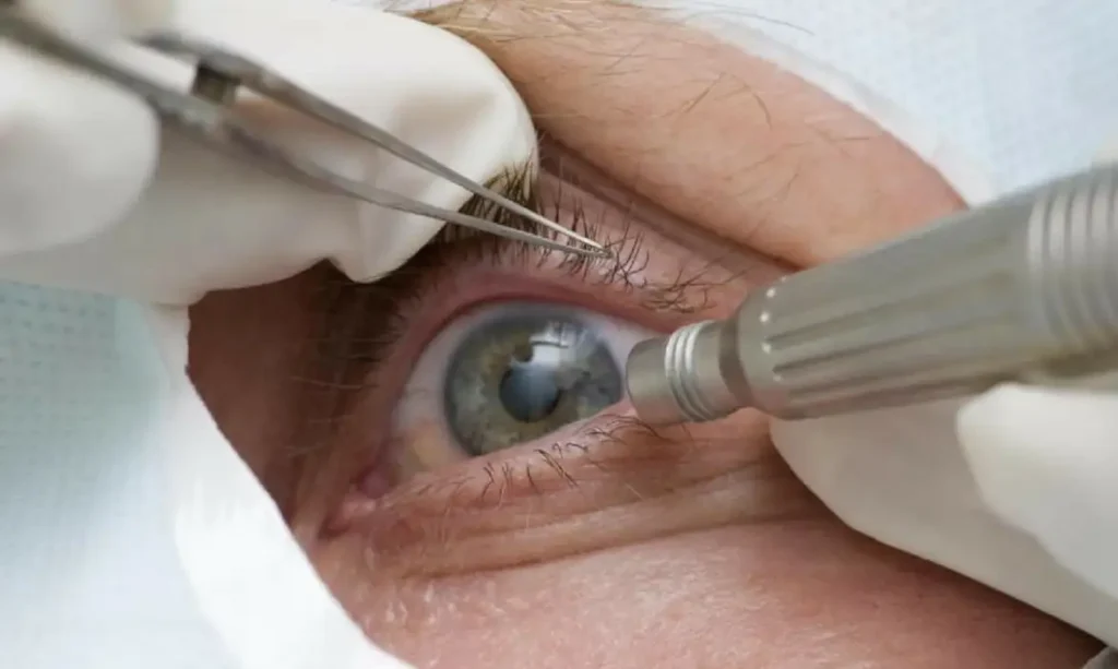 olhos