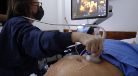 hospital do trabalhador – UTI neonatal – atendimento hospital de crianças prematuras – exame de ecografia