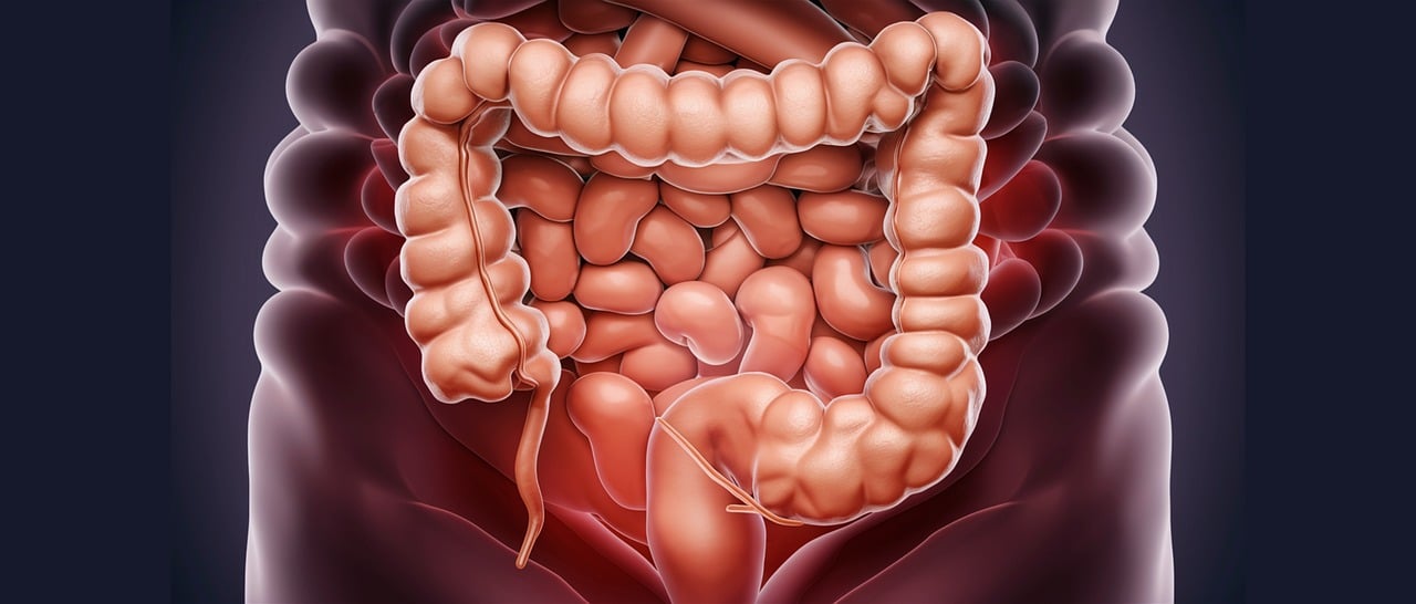 colon-8804708_1280