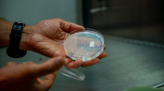 bacterias_fixadoras_Foto_Marcos_Solivan-8