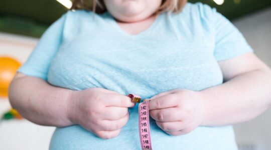 Número de obesos adultos mais que duplicou e quadruplicou entre crianças e adolescentes no período de 1990 a 2022