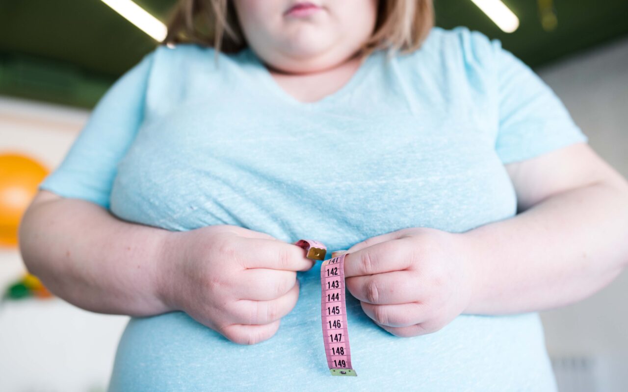 Número de obesos adultos mais que duplicou e quadruplicou entre crianças e adolescentes no período de 1990 a 2022