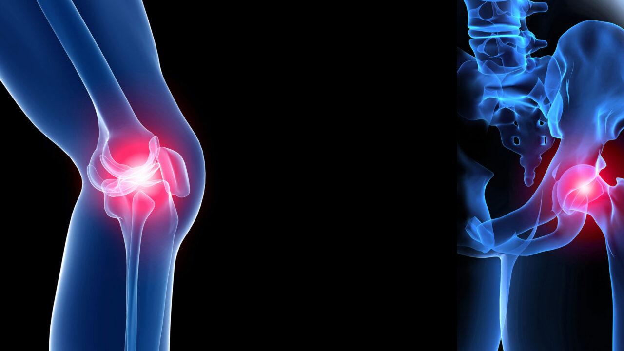 orthopaedic