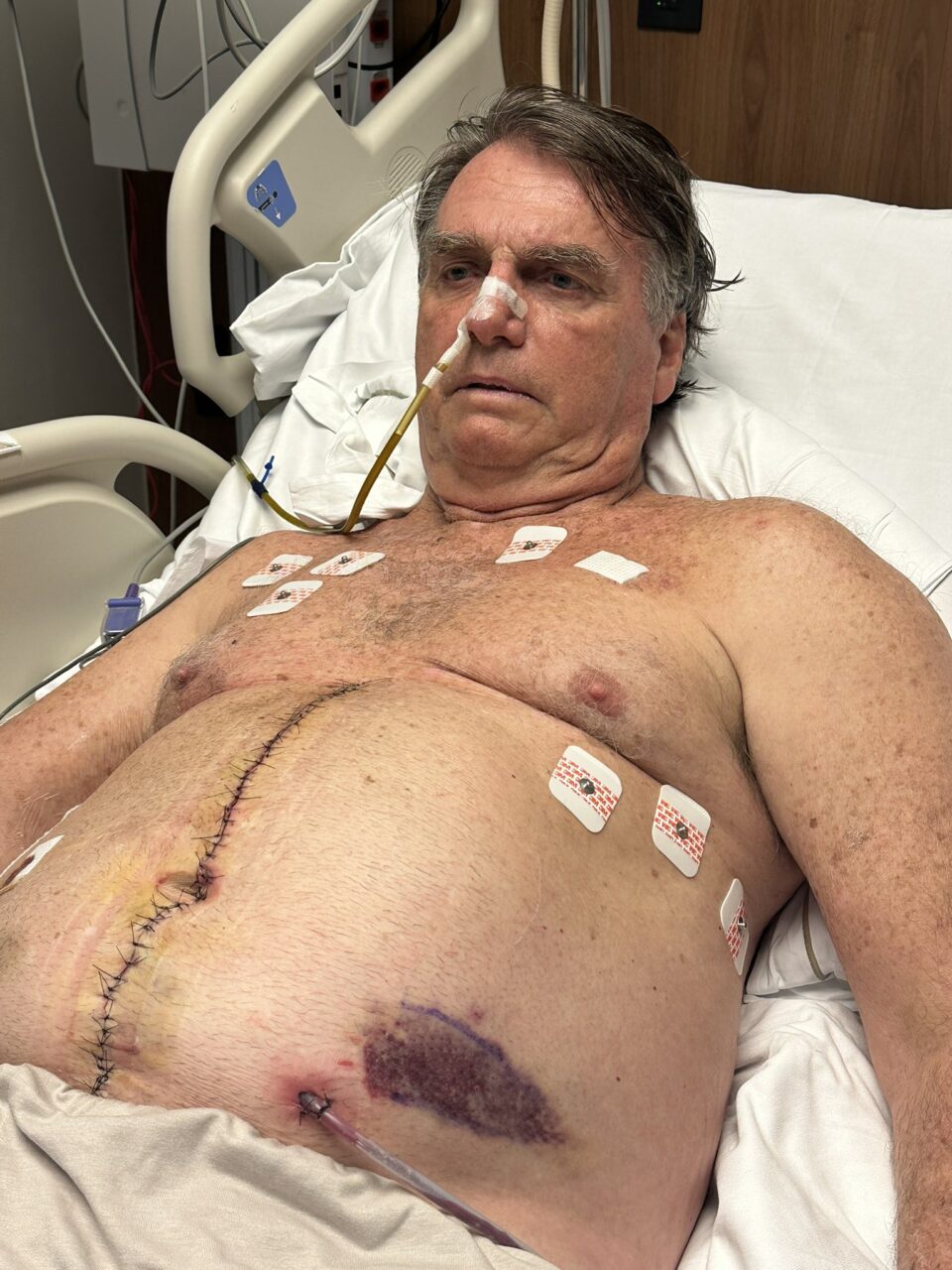 Bolsonaro internado