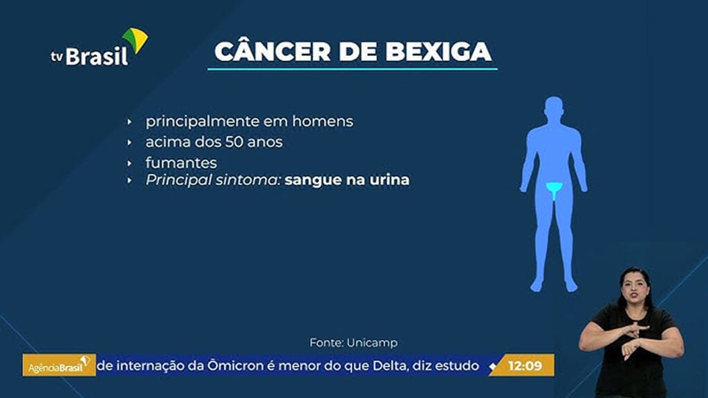 04cancerbexiga