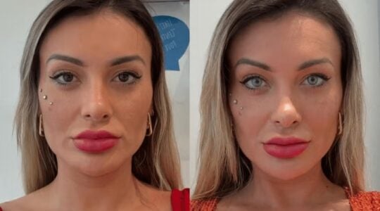 andressa-urach-faz-cirurgia-para-mudar-a-cor-dos-olhos-veja-antes-e-depois-1750777803540-v2-900×506