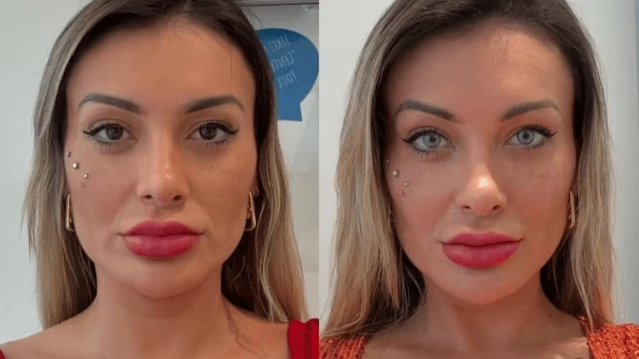 andressa-urach-faz-cirurgia-para-mudar-a-cor-dos-olhos-veja-antes-e-depois-1750777803540-v2-900×506