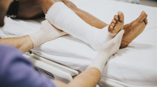 Doctor helping a patient with a fractured leg