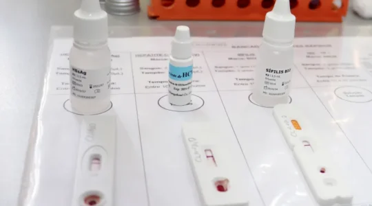 teste-rapido-HIV-Hepatite-Sifilis-neutra-Vivian-Honorato_NCom-3